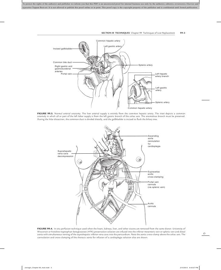 blumgart hepatobiliary surgery 5th edition